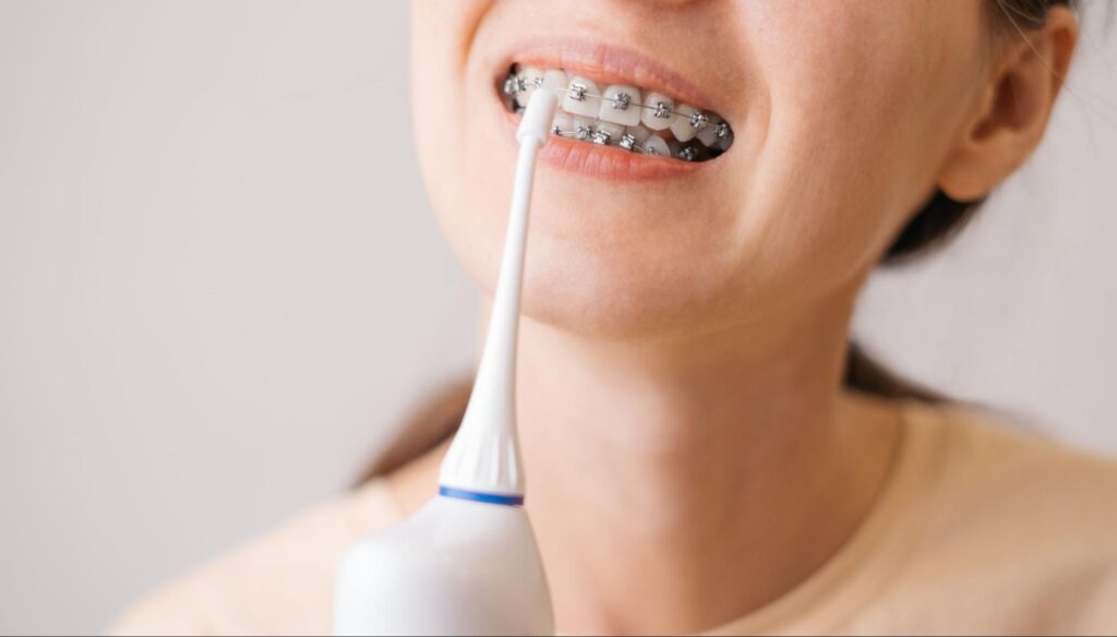 How To Care for Your Braces