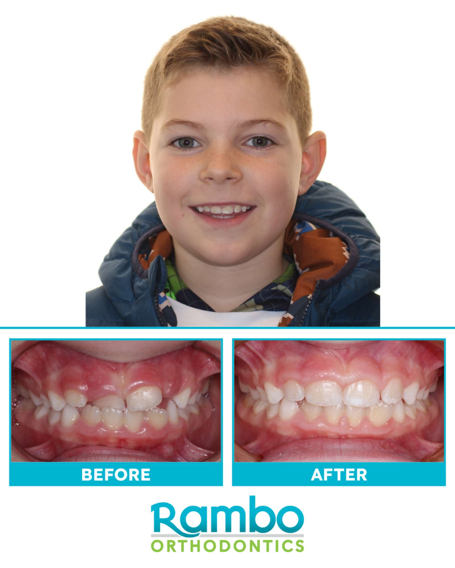 Before & Afters