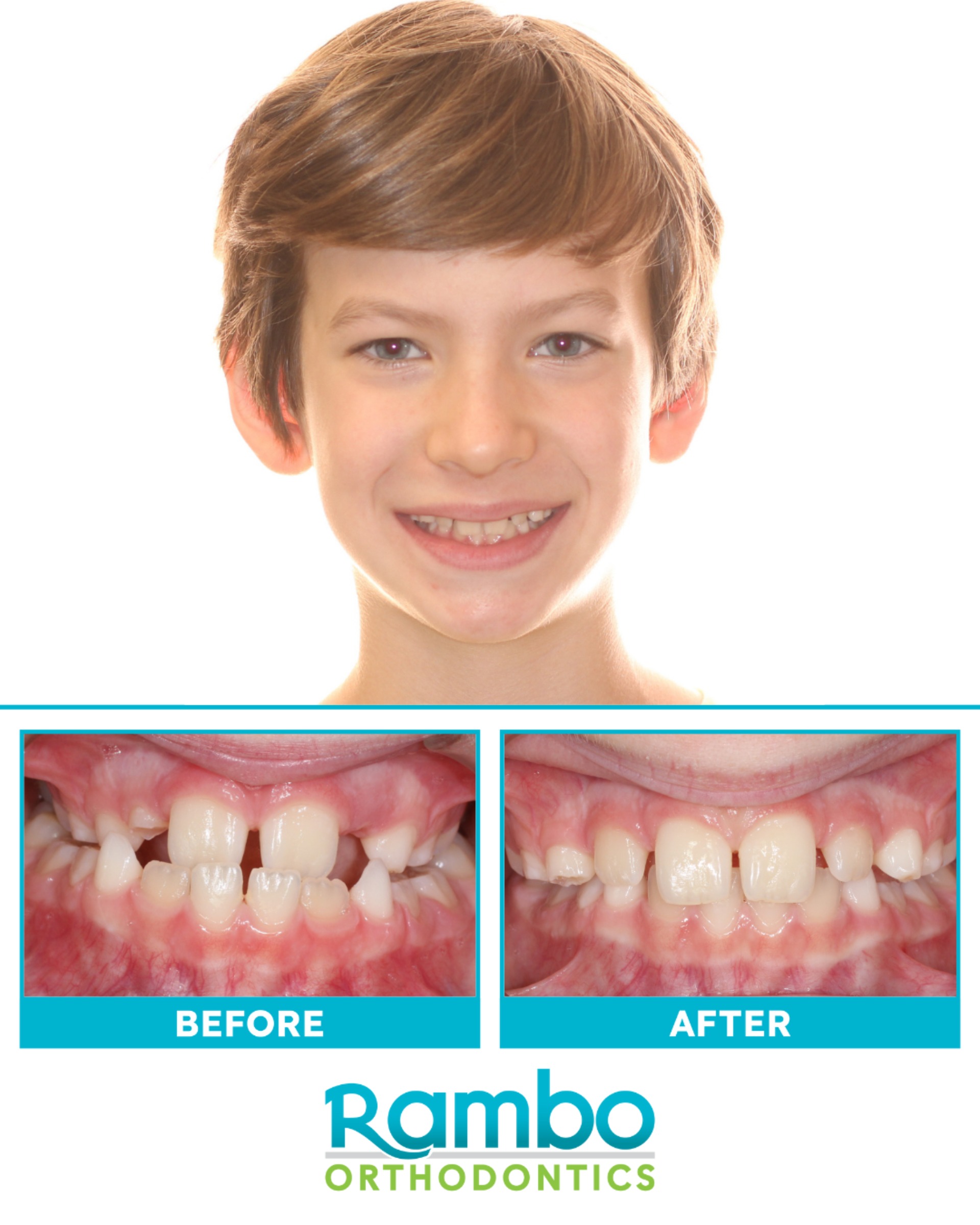 Before & Afters