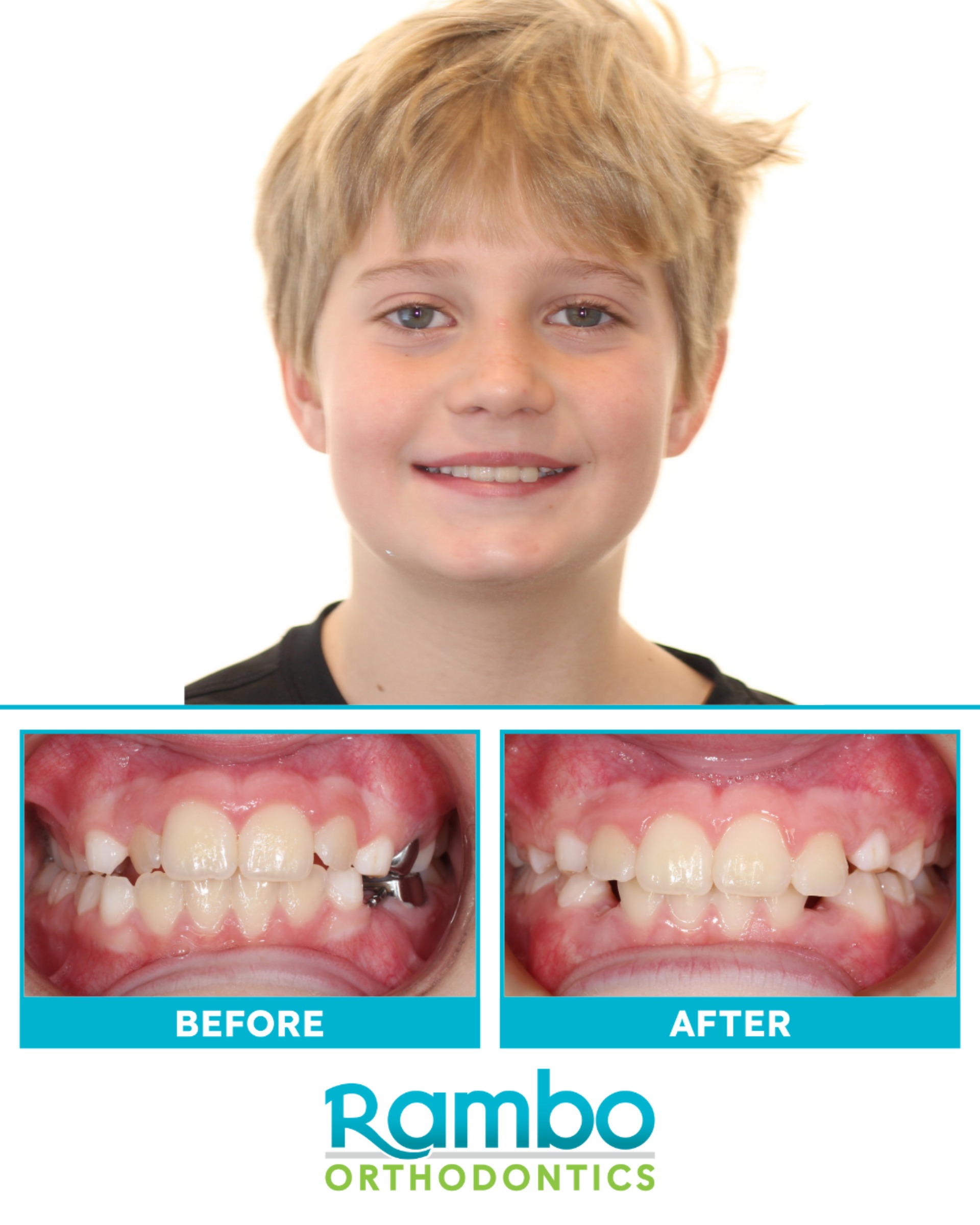 Before & Afters